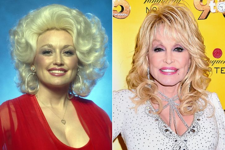 Dolly Parton: From a One-Room Tennessee Cabin to a Legacy That Reached the World